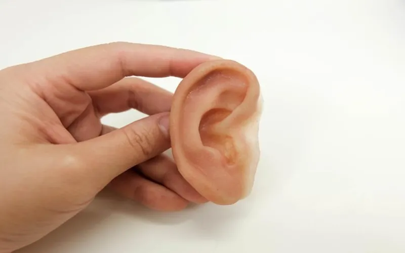 افزایش طول عمر پروتز گوش خارجی