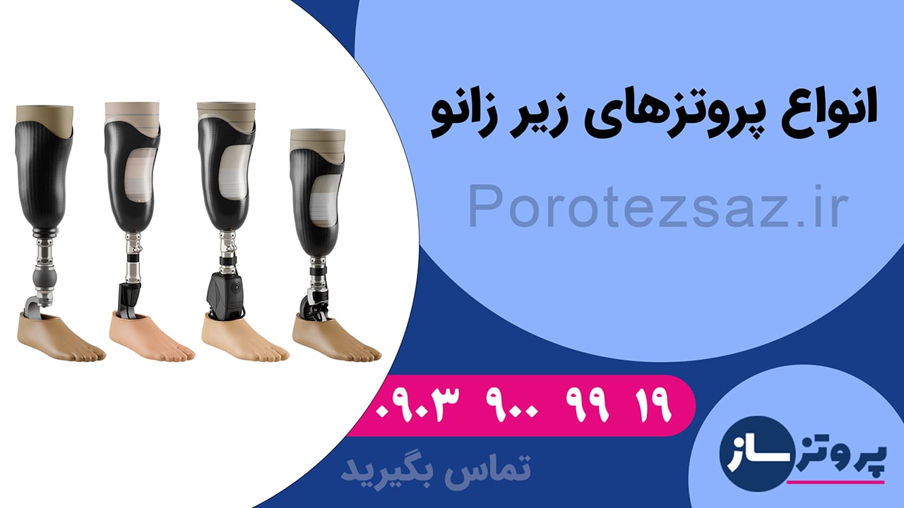 بررسی انواع پروتز پای زیر زانو