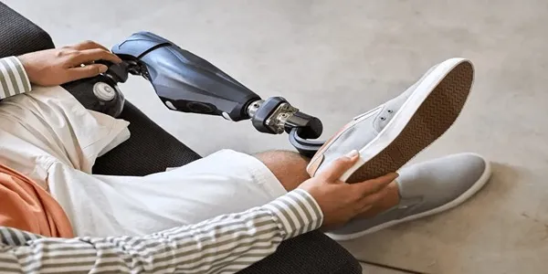 مراحل دریافت پای مصنوعی