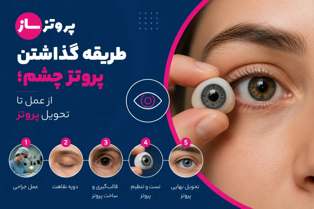 روش گذاشتن پروتز چشم