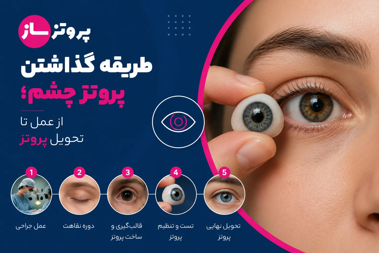 روش گذاشتن پروتز چشم